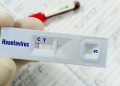 Warga Kulon Progo Suspek Virus Hanta Dinyatakan Tidak Terpapar