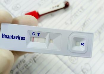 Warga Kulon Progo Suspek Virus Hanta Dinyatakan Tidak Terpapar