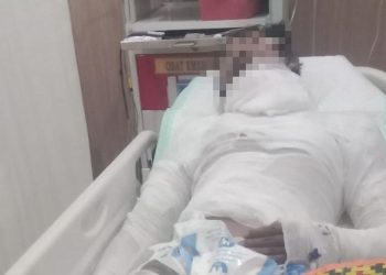 Sopir Truk Bali yang Dibakar Bosnya Meninggal Setelah Seminggu Kritis