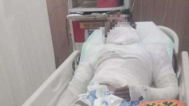 Sopir Truk Bali yang Dibakar Bosnya Meninggal Setelah Seminggu Kritis
